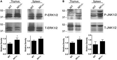 Neurofibromin 1 Impairs Natural Killer T-Cell-Dependent Antitumor Immunity against a T-Cell Lymphoma